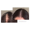 image:imageVirtue Flourish Hair Growth Regimen for Women with Minoxidil 5 Foam for Fine or Thinning Hair Sulfate Free Color Safe